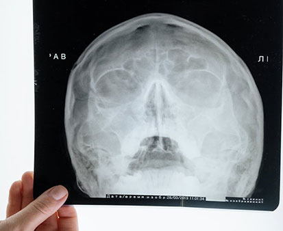 Oral Pathology | Ghobadi Oral & Maxillofacial Surgery