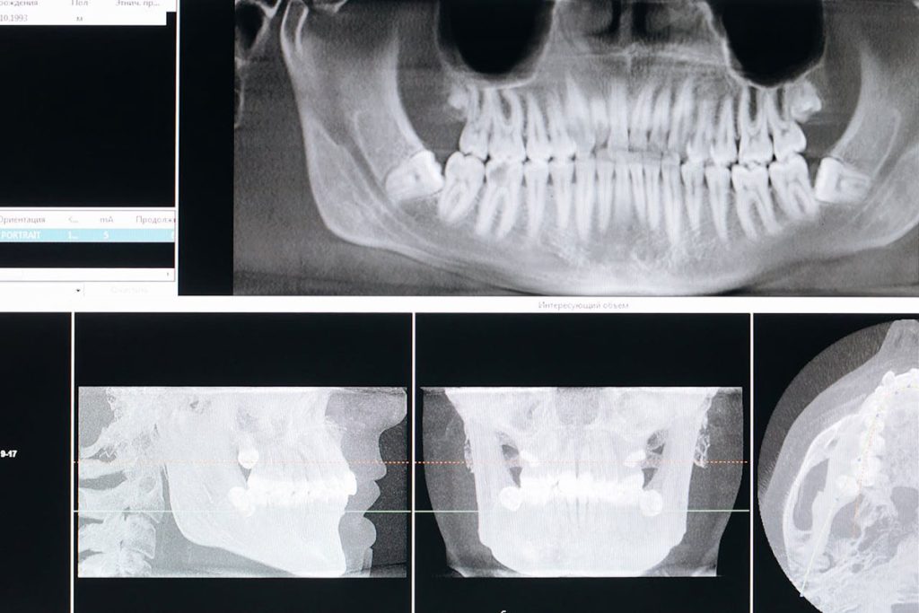 Oral Pathology | Ghobadi Oral & Maxillofacial Surgery