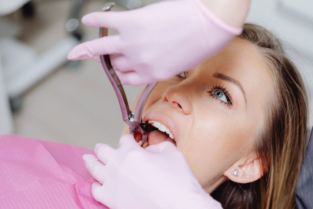 Tooth Extraction | Ghobadi Oral & Maxillofacial Surgery