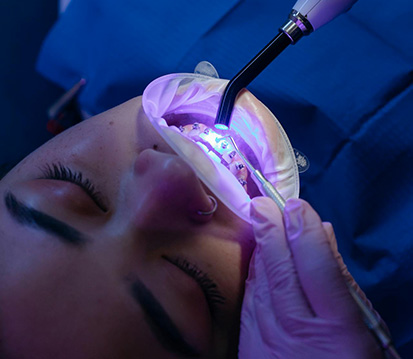 Sedation Dentistry | Ghobadi Oral & Maxillofacial Surgery