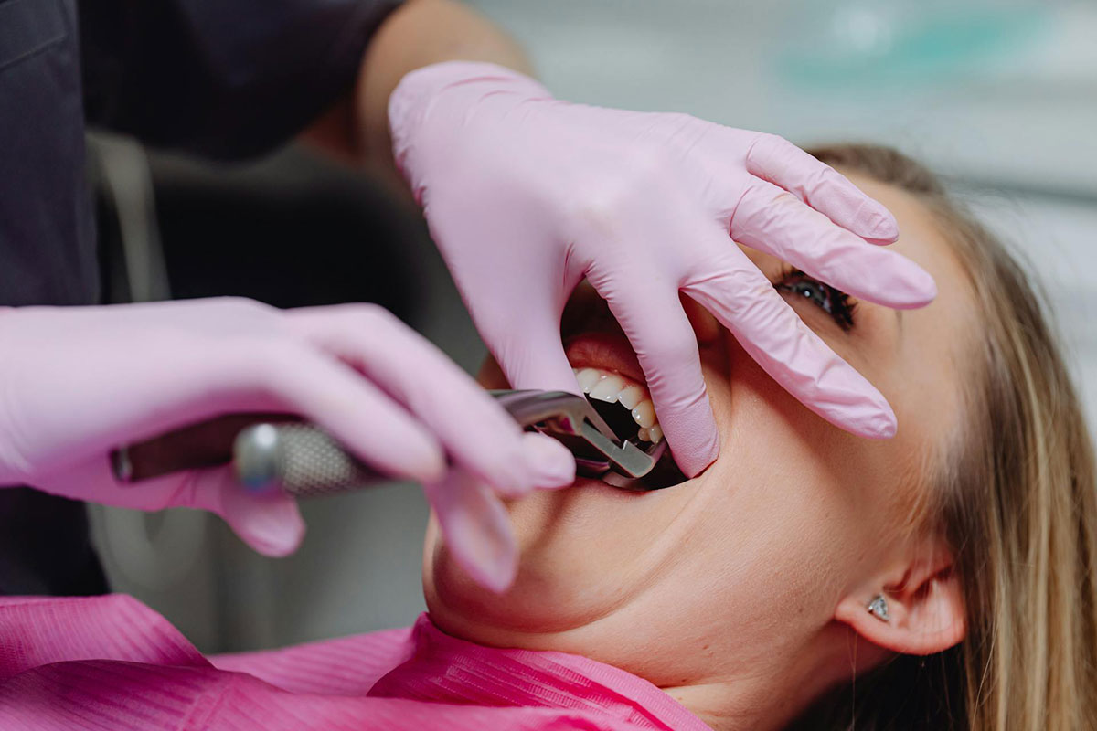 Tooth Extraction | Ghobadi Oral & Maxillofacial Surgery